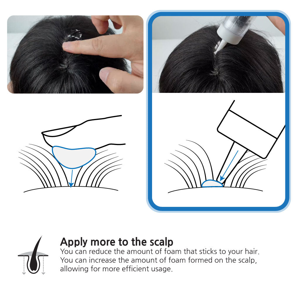 Inveneed Minoxidil Foam Applicator applying Rogaine foam directly to scalp